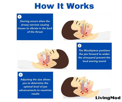 SnoreGuard™ Mouthpiece